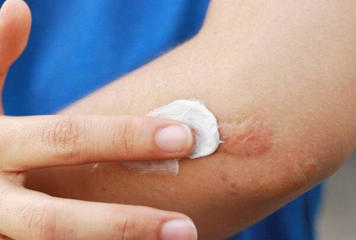 کرم ترمیم‌کننده پوست؛ راهنمای انتخاب، کاربردها و نکات ایمنی برای مصرف روزانه